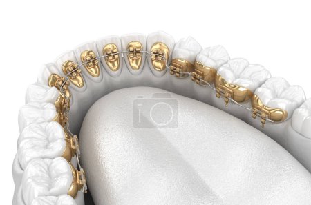 Foto de Dientes sanos con tirantes dorados, concepto de estilo blanco, ilustración 3D dental - Imagen libre de derechos