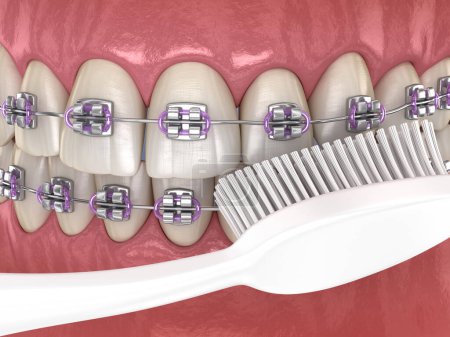 Proceso de limpieza de cepillos de dientes. Ilustración 3D médicamente precisa de la higiene bucal.
