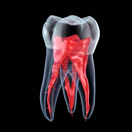 Foto de Anatomía de la raíz dental - Primer diente molar maxilar. Ilustración dental 3D - Imagen libre de derechos