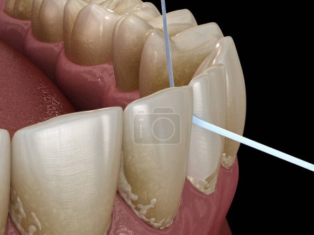Photo for Oral hygiene: using dental floss for plaque removing. Dental 3D illustration - Royalty Free Image