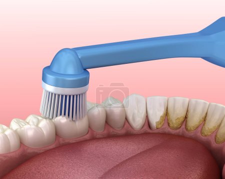 Foto de Cepillo de dientes eléctrico limpiando dientes, aislado en blanco. Ilustración 3D médicamente precisa de la higiene bucal. - Imagen libre de derechos
