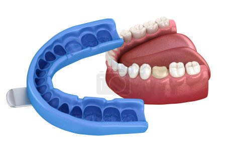 Zahnärztlicher Eindruck. Behandlungsplanung. Medizinisch korrekte 3D-Darstellung der Zähne