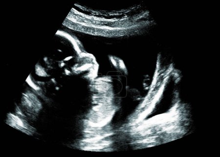 Photo for Ultrasound ofa baby in mother's womb - Royalty Free Image