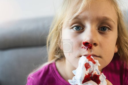Téléchargez les photos : Enfant essayant d'arrêter le saignement de sang du nez. Epistaxis d'un enfant. Sang du nez Gros plan, saignements de nez - en image libre de droit