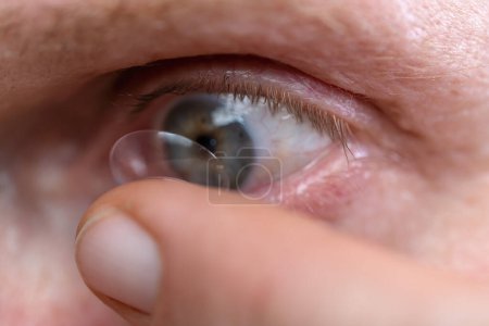 Makroaufnahme eines Auges mit einer Kontaktlinse, die von einem Finger aufgetragen wird