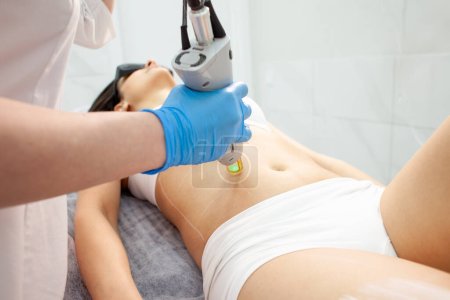 Epilation of the abdomen in a cosmetology clinic. Doctor cosmetologist makes a procedure for removing hair on the abdomen with an alexandrite laser, close-up