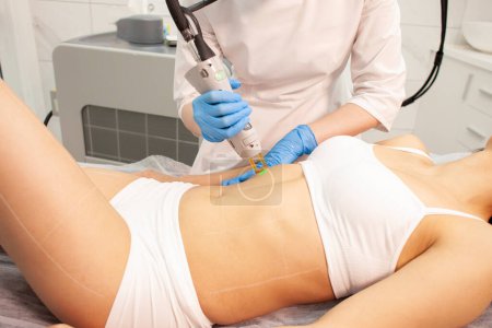alexandrite laser hair removal procedure in cosmetology clinic, cosmetologist doctor in uniform makes depilation of the abdomen of girl patient with modern equipment