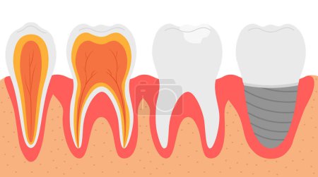 Illustration for Diverse types of teeth, vector illustration - Royalty Free Image