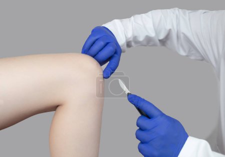 Photo for Knee surgery. Orthopedic surgeon shows patient where the incision will be made to repair the tendon, cartilage, and eliminate the effects of arthralgia. Concept of providing qualified care to patients - Royalty Free Image
