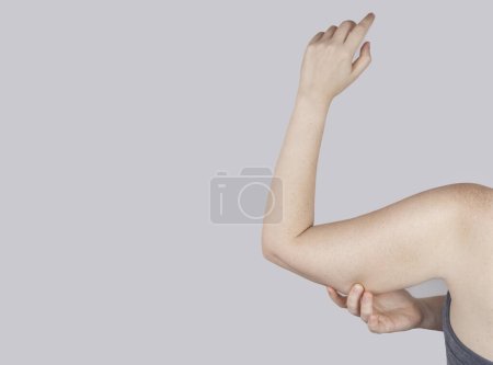 Téléchargez les photos : Obésité Cellulite. Peau flasque affaissée sur un bras de femme. Avant et après. Concept de perdre du poids, de faire du sport, de vérifier le résultat d'un régime alimentaire et d'un entraînement intense. Résultat de la perte de poids. Liposuccion - en image libre de droit