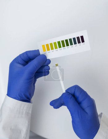 Photo for Bacterial Vaginosis. Vaginal pH. Diagnostic. Scale by which you can measure whether acidity normal or not. Normal acidity level shown in colors and must be compared with standard. Laboratory and home - Royalty Free Image