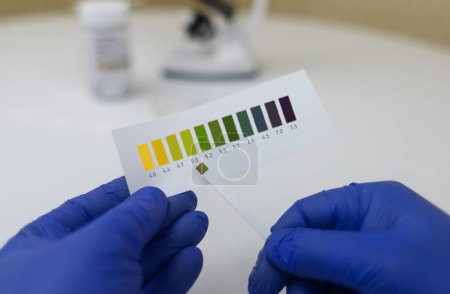 Photo for Bacterial Vaginosis. Vaginal pH. Diagnostic. Scale by which you can measure whether acidity normal or not. Normal acidity level shown in colors and must be compared with standard. Laboratory and home - Royalty Free Image