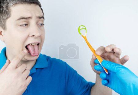 Tongue scraper. Man shows yellow plaque and then performs oral hygiene. Cleaning the tongue with special tool. Doctor recommendations and dentist advice. Before and after. Removing unpleasant odor