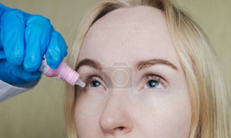 Examen du fond d'oeil et des pupilles dilatées. Un médecin effectue une ophtalmoscopie sur une femme qui a une mydriase et un spasme d'hébergement. Mauvaise vision et paralysie des muscles oculaires