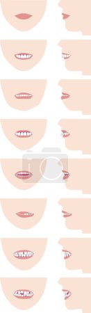 Tipos de alineación dental y maloclusión. Ilustración vectorial de cara frontal y perfil