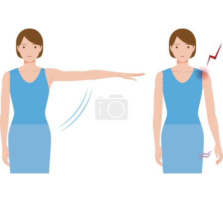 Illustration for A woman whose shoulder hurts due to frozen shoulder and periarthritis and cannot raise her hand to the side. - Royalty Free Image