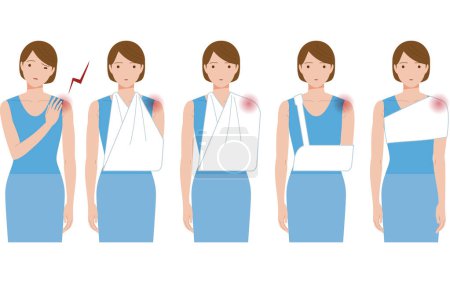 Illustration for Shoulder pain due to frozen shoulder or periarthritis. A woman hanging her arms with triangular cloth, etc. - Royalty Free Image