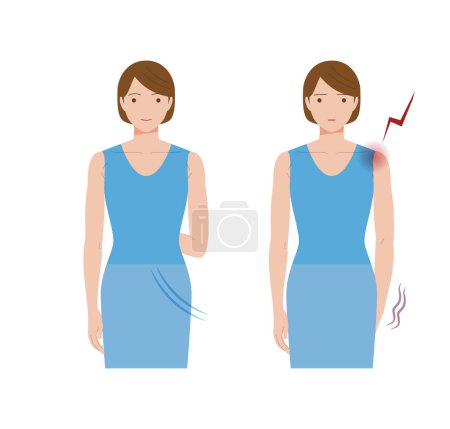 Eine Frau, deren Hände sich wegen eingefrorener Schultern und Periarthritis nicht hinter ihrem Rücken bewegen können.