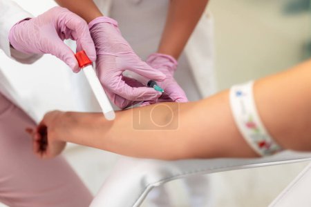 Téléchargez les photos : L'infirmière prend le sang de la main du patient - en image libre de droit