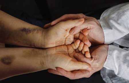 Foto de Doctor Nand sosteniendo la mano del paciente con traumatismos en el hospital o refugio. Concepto de apoyo médico y social. - Imagen libre de derechos