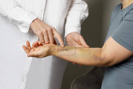 Photo for Doctor examining bruises on her patient's arm. Medicine and treatment concept - Royalty Free Image