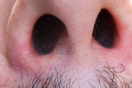 Téléchargez les photos : Les coiffeurs du nez se rapprochent. Un homme lui arrache un cheveu du nez, macro. Concentration sélective - en image libre de droit