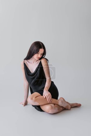 Pretty woman with vitiligo touching leg while sitting on grey background