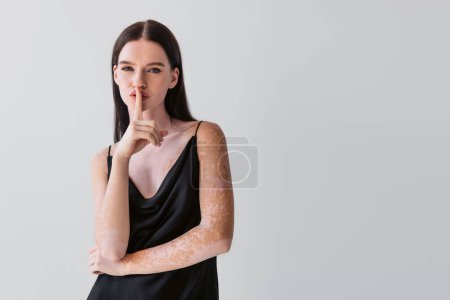 Stylish young woman with vitiligo showing secret gesture isolated on grey 