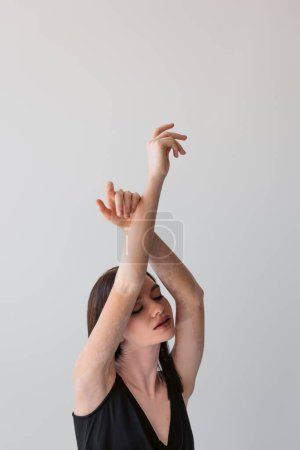 Mujer joven bonita con vitiligo levantando las manos y cerrando los ojos aislados en gris 