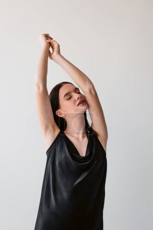 Sensual model with vitiligo raising hands isolated on grey 