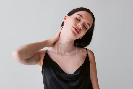 Mujer joven con vitiligo tocando el cuello y cerrando los ojos aislados en gris 