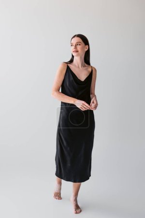 Longitud completa del modelo elegante con vitiligo posando en vestido de seda sobre fondo gris 