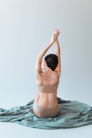 Rückseite der brünetten Frau mit Vitiligo chronischen Hautzustand sitzt mit erhobenen Händen auf Decke auf grauem Hintergrund 