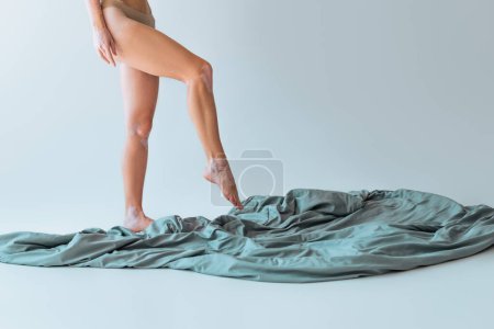 partial view of woman with vitiligo chronical skin condition standing near blanket on grey background 