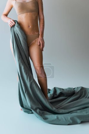 cropped view of woman with vitiligo skin condition holding blanket while standing on grey 