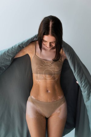 young woman with vitiligo skin condition standing in underwear and covering in blanket isolated on grey 