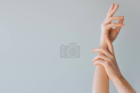 cropped view of elegant female hands with vitiligo isolated on grey