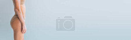 Photo for Cropped view of young woman with vitiligo standing in underwear isolated on grey, banner - Royalty Free Image