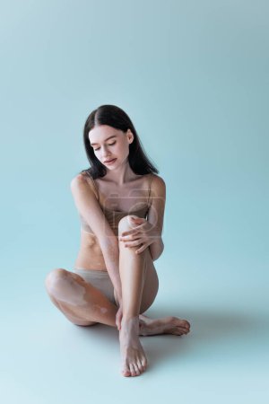 Full length of barefoot young woman with vitiligo sitting in beige lingerie on grey