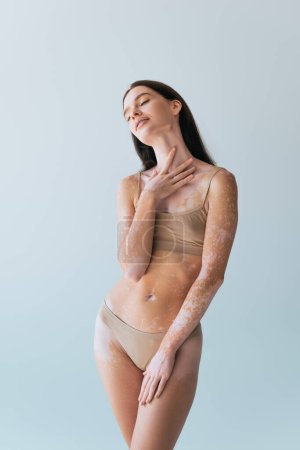 young woman with vitiligo touching chest while posing with closed eyes isolated on grey 