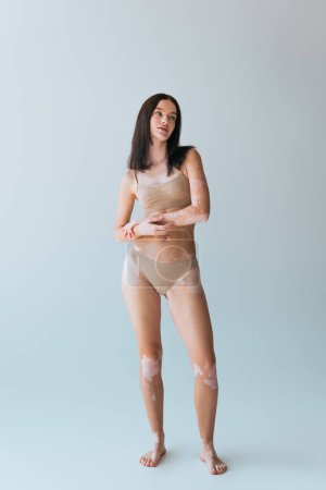full length of brunette young woman with vitiligo posing in beige lingerie while looking away on grey