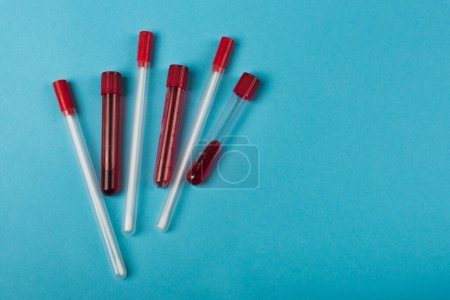 Photo for Test tubes with blood samples near cotton swabs on blue background - Royalty Free Image