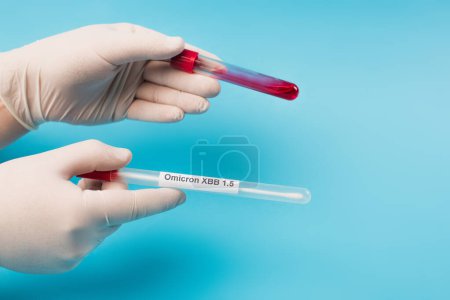 Photo for Cropped view of doctor in latex gloves holding blood sample and cotton swab with omicron lettering on blue background - Royalty Free Image
