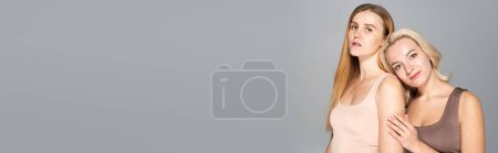 Téléchargez les photos : Femme souriante avec acné debout près d'un ami avec des taches de rousseur isolées sur gris, bannière - en image libre de droit