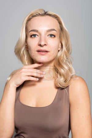 Jolie femme blonde avec acné touchant le cou isolé sur gris 