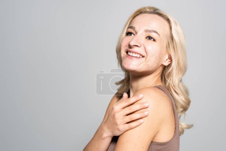 Positive blonde woman with acne touching shoulder isolated on grey 
