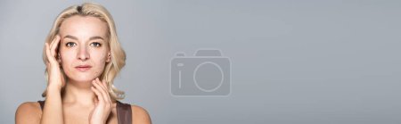 Blonde Frau mit Hautproblem blickt in Kamera isoliert auf graues Banner 