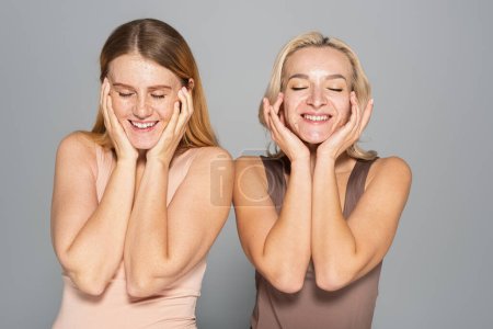 Sonrientes mujeres interracial con problemas de piel tocando la cara aislada en gris 