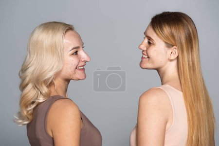 Foto de Vista lateral de amigos sonrientes con problemas de piel mirándose aislados en gris - Imagen libre de derechos