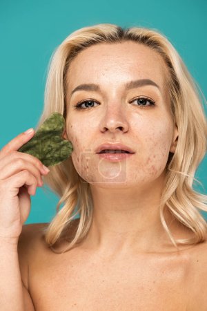 mujer rubia con manchas masajeando la cara con raspador de jade aislado en turquesa